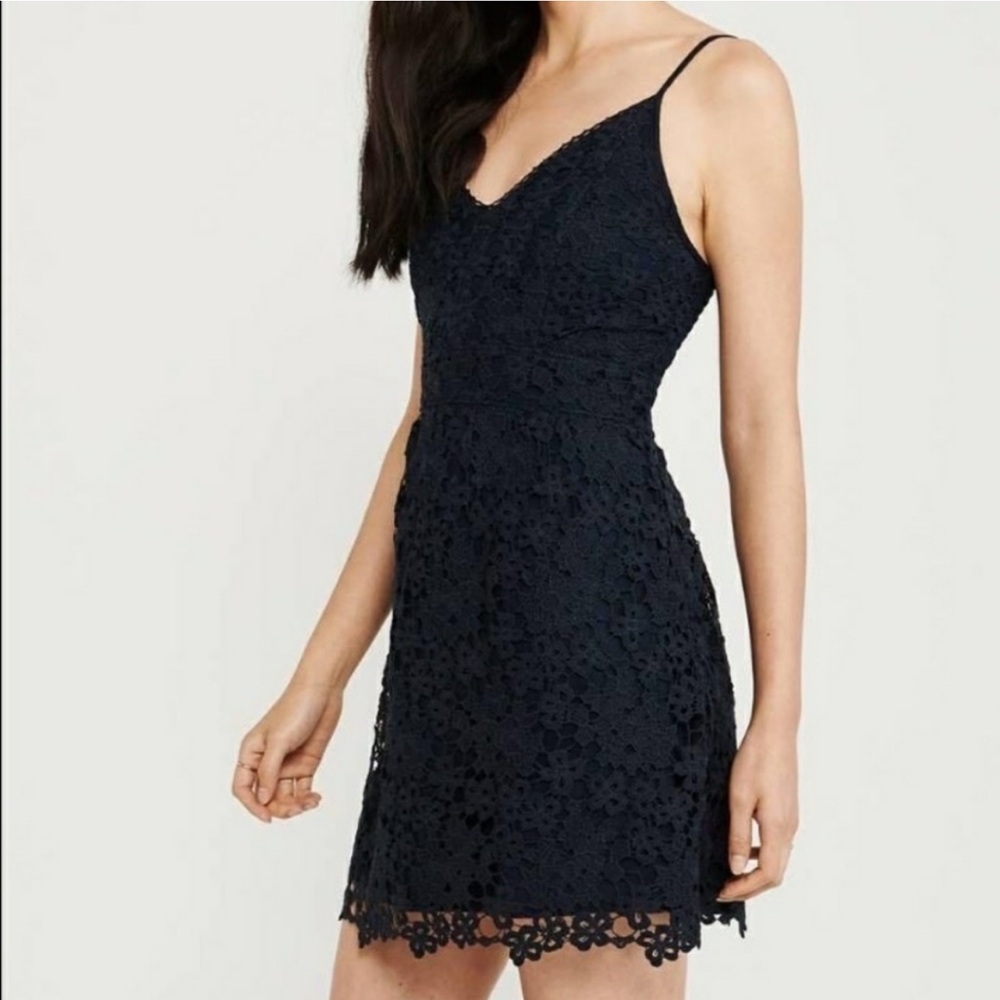 Abercrombie and Fitch Lace Dress